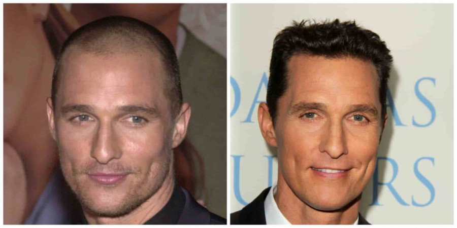 Matthew McConaughey's Hair Transformation: How Did He Get It Back?